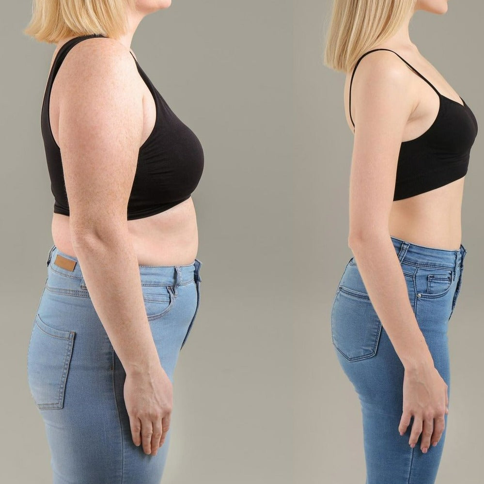 VItalSmyle CelAway™ | ¡Dile adiós a la grasa y la celulitis!